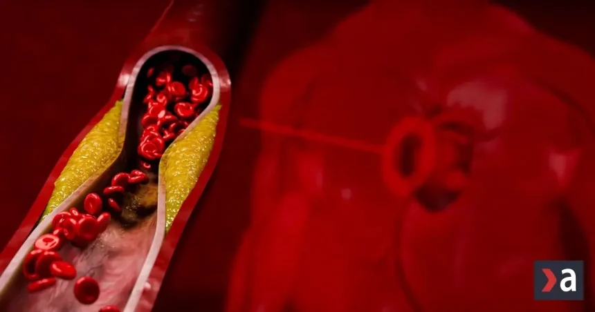 Tiché signály na koži, očiach a šľachách: Ako odhaliť vysoký cholesterol včas?